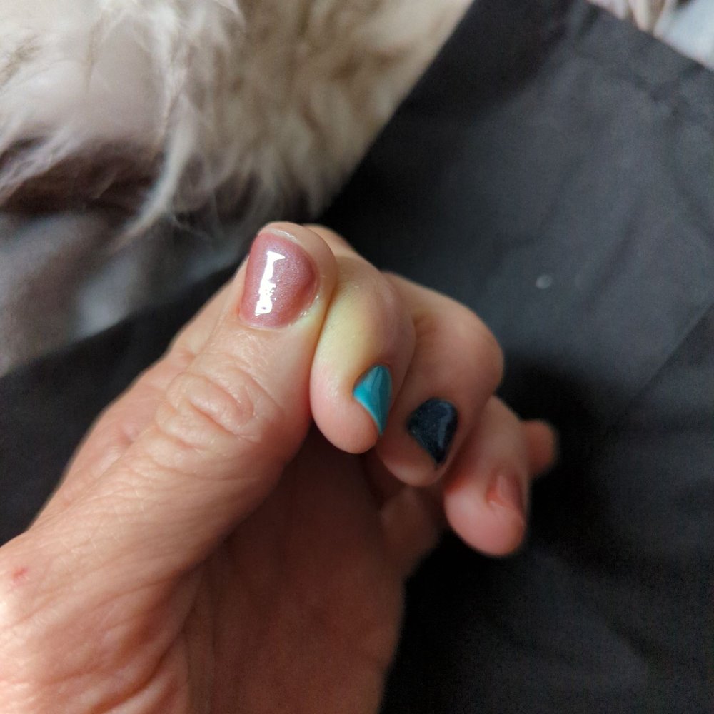 Cuticles.. that should have been removed..