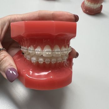 Blue Wave Orthodontics - Standard braces - Orthodontists Near Me - Tampa, Florida Blue Wave Orthodontics - Standard braces - Orthodontists Near Me - Tampa, Florida