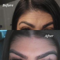 Luxe Skyn Studio - Chemical Peel