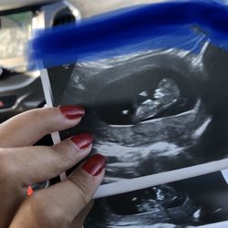 MOMMY AND ME 3D 4D ULTRASOUND - 277 Photos & 453 Reviews - 411 Camino ...