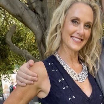 Restore Med Clinic - After facial threads and Botox with Julie! - Hair Loss Centers Near Me - Newport Beach, California Restore Med Clinic - After facial threads and Botox with Julie! - Hair Loss Centers Near Me - Newport Beach, California
