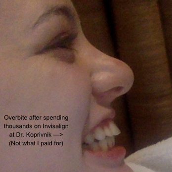 Stevan A Koprivnik, DDS - Sold me Invisalign that didn't work... - General Dentistry Near Me - Austin, Texas