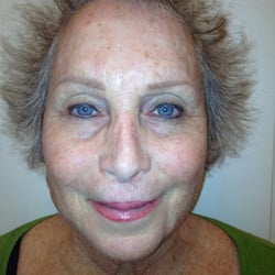 Contra Costa Oncology - After picture