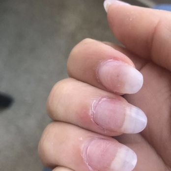 Lovely Nails - My nails when i got home and took the polish off - Nail Salons Near Me - Clovis, California