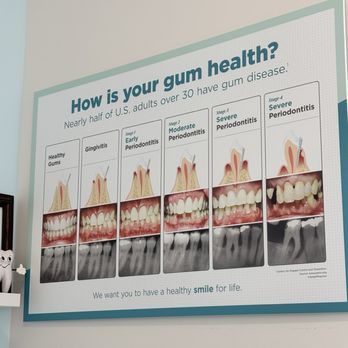 University Modern Dentistry - Have you had your gum health checked? - General Dentistry Near Me - Charlotte, North Carolina University Modern Dentistry - Have you had your gum health checked? - General Dentistry Near Me - Charlotte, North Carolina