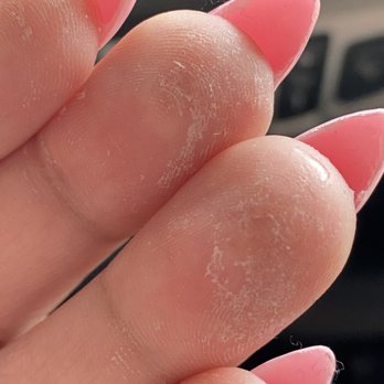 Nails Unlimited - more gunk - Nail Salons Near Me - Wilsonville, Oregon Nails Unlimited - more gunk - Nail Salons Near Me - Wilsonville, Oregon