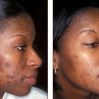 A Hair Spot - Skincare service available - Hair Salons Near Me - Houston, Texas