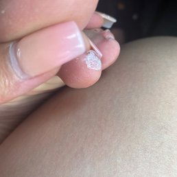 the glue she put on my toe the glue she put on my toe