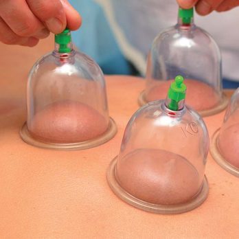 Asian Wellness Spa - Cupping - Massage Near Me - Vancouver, Washington