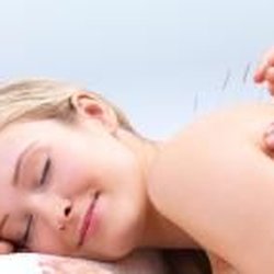 Serene Balance Acupuncture - Post