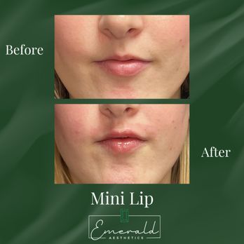 Emerald Aesthetics - Medical Spas Near Me - Pensacola, Florida
