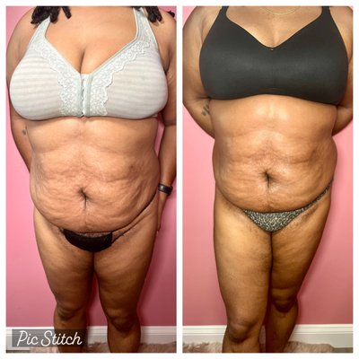 BLINGTOOTH BEAUTY BAR - Updated October 2025 - 4700 Stamp Rd