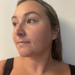 Radiant Mountain Massage  - Day after of micro-needling