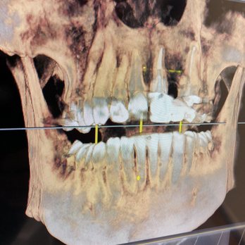 Boulder Canyon Dental - Orthodontists Near Me - Boulder, Colorado