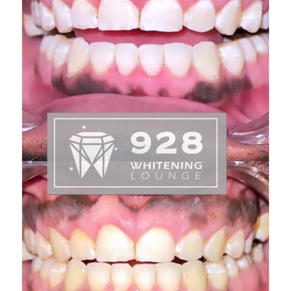 928 Whitening Lounge Logo