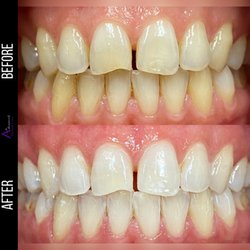 Advanced Dental Care - Schedule your dental exam, hygiene appointment, and teeth whitening for a quick and easy way to refresh your smile!
