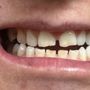 Photo of Beautiful Smiles of Arizona