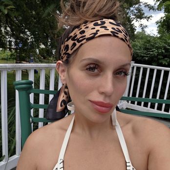 Mia Bella Aesthetics - one week post facial balancing - IV Hydration Near Me - Middletown, Delaware Mia Bella Aesthetics - one week post facial balancing - IV Hydration Near Me - Middletown, Delaware
