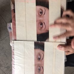 James Zhong - Acupuncture and Herbs - After treatment, look at the eyes