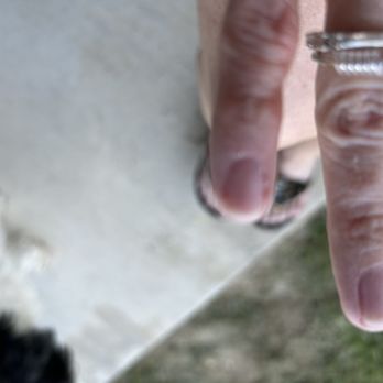 Diva Nails & Lashes - Example of damage to skin surrounding nail bed - Nail Salons Near Me - Celina, Texas Diva Nails & Lashes - Example of damage to skin surrounding nail bed - Nail Salons Near Me - Celina, Texas