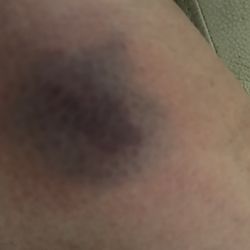 Above my knee