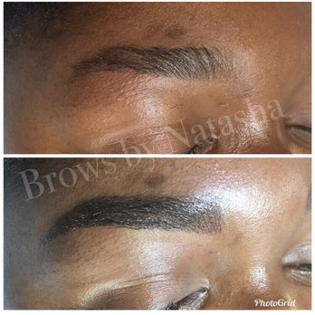 Skin Solutions - Before and after my first session. - Skin Care Near Me - Houston, Texas