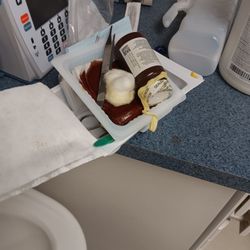 Piedmont Medical Center - Medical waste from the procedure. The urologist did not have a medical waste bin for it.