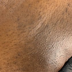 The Brown Skin