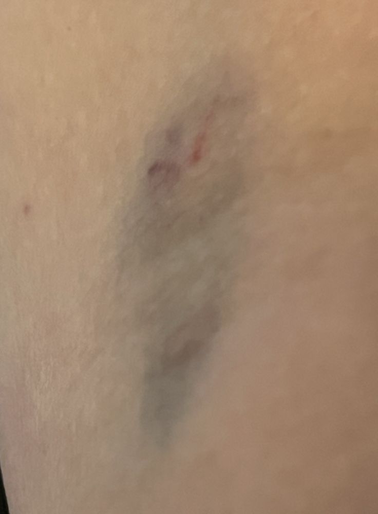 Bay West Endocrinology Associates - patient advocate in Timonium, MD