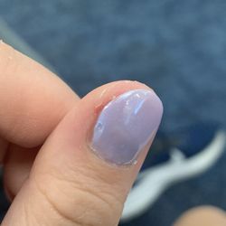 Tip'nToe - Uneven gel polish application and angry inflamed skin where she cut.