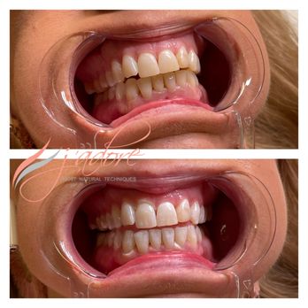 J'adore Clermont - Teeth whitening - Permanent Makeup Near Me - Clermont, Florida