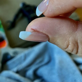 Nail Nation Studio - My finger is swollen and in pain. Everything that touches it stings. The nail file cut me open 3 times. Super painful and tender - Nail Salons Near Me - Burbank, California