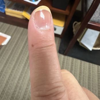 Gel Nails Spa - this photo - you can see how the white tip doesn't even cover the tip. ugh. - Nail Salons Near Me - Lafayette, California
