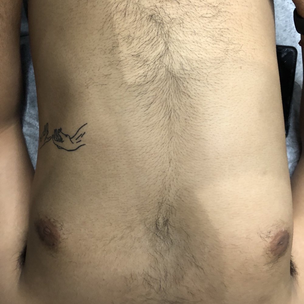 Project Glow - Torso before the wax - Eyelash Service Near Me - Piedmont, California Project Glow - Torso before the wax - Eyelash Service Near Me - Piedmont, California