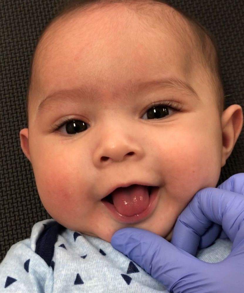 Center For Infant Tethered Oral Ties - child therapist in San Marino, CA