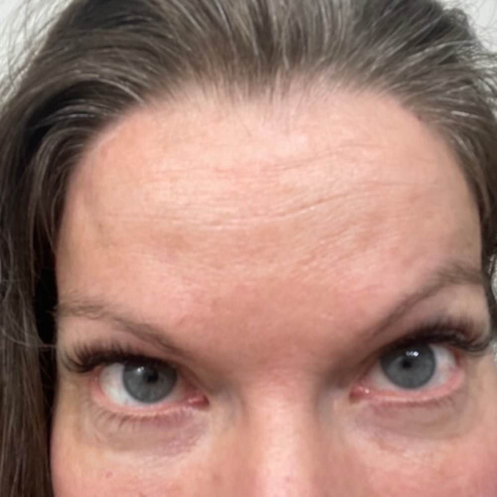 Lashology - Hair Removal Near Me - Denver, Colorado Lashology - Hair Removal Near Me - Denver, Colorado