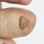 Photo of Prettyy Girl Nails