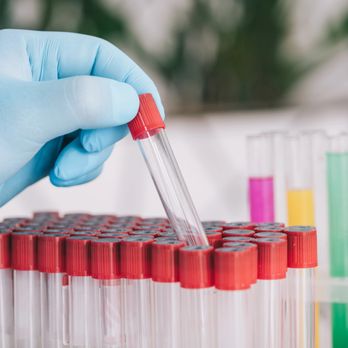 Coastline Mobile Phlebotomy - Laboratory Testing Near Me Coastline Mobile Phlebotomy - Laboratory Testing Near Me