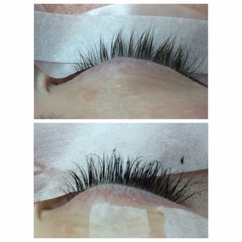 My Shanti Bar - My before and after. So pretty! - Hair Removal Near Me - Los Angeles, California My Shanti Bar - My before and after. So pretty! - Hair Removal Near Me - Los Angeles, California