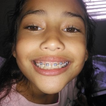Crawford Orthodontics - Bella feels amazing! - Orthodontists Near Me - Lincoln, California