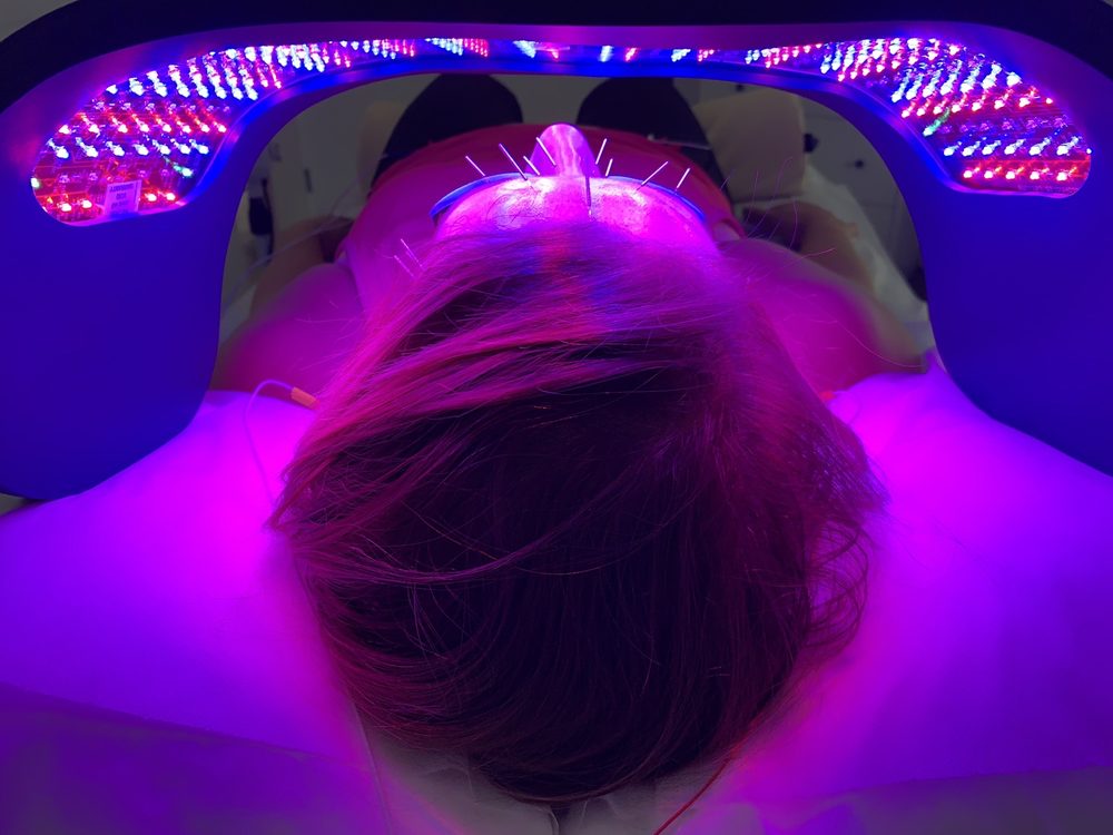 ACUPUNCTURE + RESTORATIVE MEDICINE Updated August 2024 11 Photos & 17 Reviews 13110 Hwy