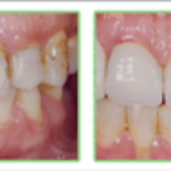 Sam English, DDS