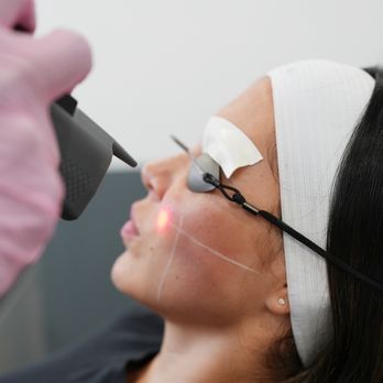 LaserAway - Tattoo Removal Near Me - Tucson, Arizona LaserAway - Tattoo Removal Near Me - Tucson, Arizona