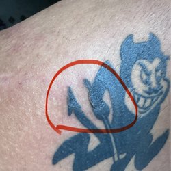 Tempe Laser Center - Tattoo