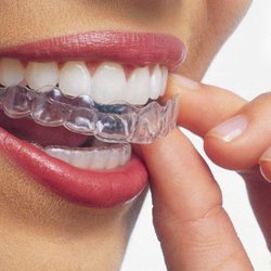 Certified Invisalign Provider