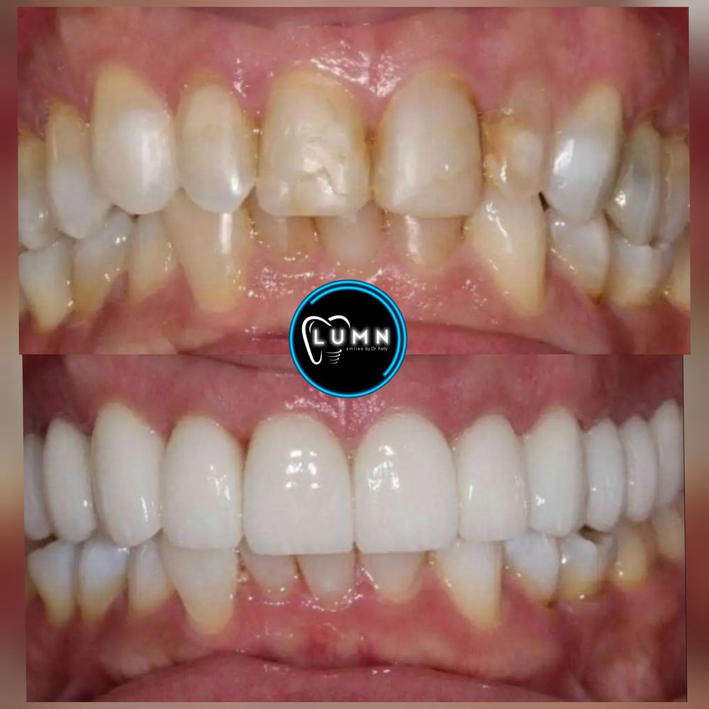 LUMN Smiles Logo