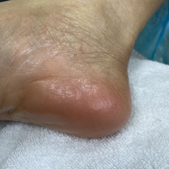 Paradise Nails & Spa - Husband's heels after pedicure - Nail Salons Near Me - Vancouver, Washington Paradise Nails & Spa - Husband's heels after pedicure - Nail Salons Near Me - Vancouver, Washington