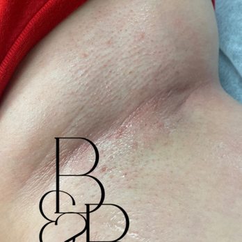 Brows & Below - Underarm Wax "After" - Waxing Near Me - Salem, Oregon