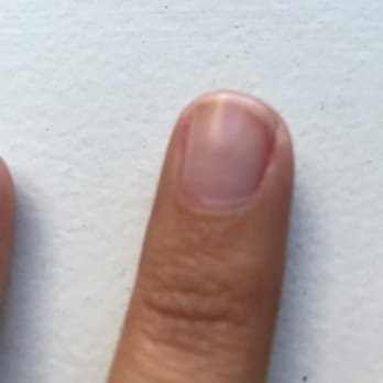 Nail Trix - Look at the cuticle. See that red bit. That's where they cut me after I specifically told them not to touch my cuticles. - Nail Salons Near Me - Salt Lake City, Utah Nail Trix - Look at the cuticle. See that red bit. That's where they cut me after I specifically told them not to touch my cuticles. - Nail Salons Near Me - Salt Lake City, Utah