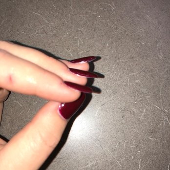 Classy Nails By Le - You can see how lifted the back nail is compared to the others - Nail Salons Near Me - Tucson, Arizona